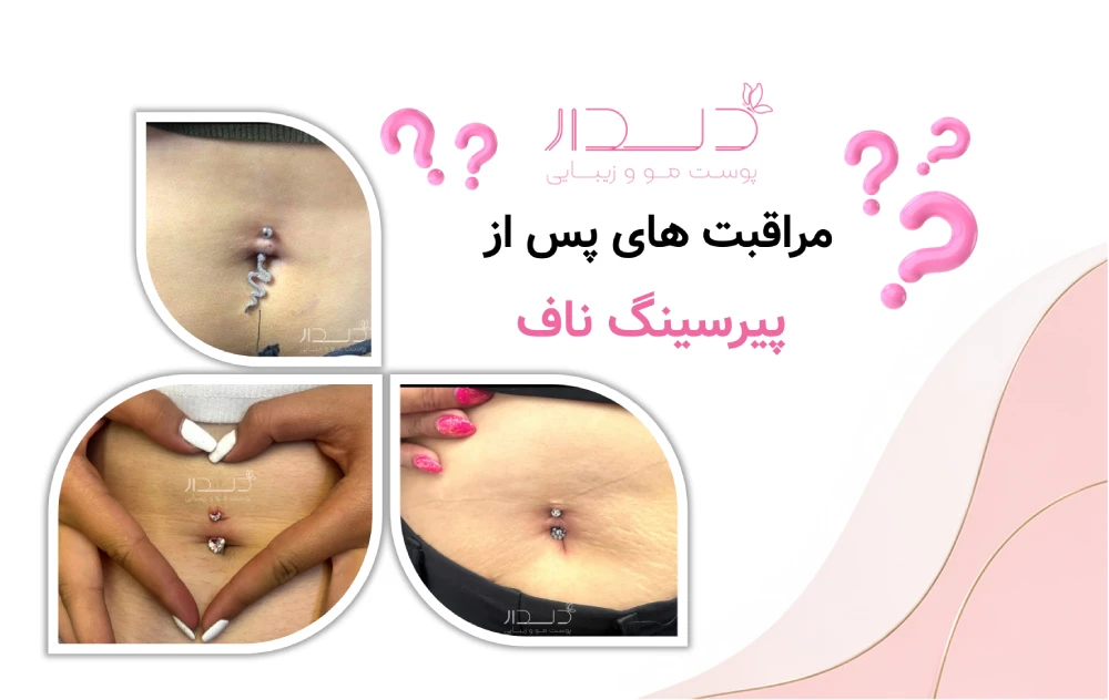مراقبت های که پس از پیرسینگ ناف 
