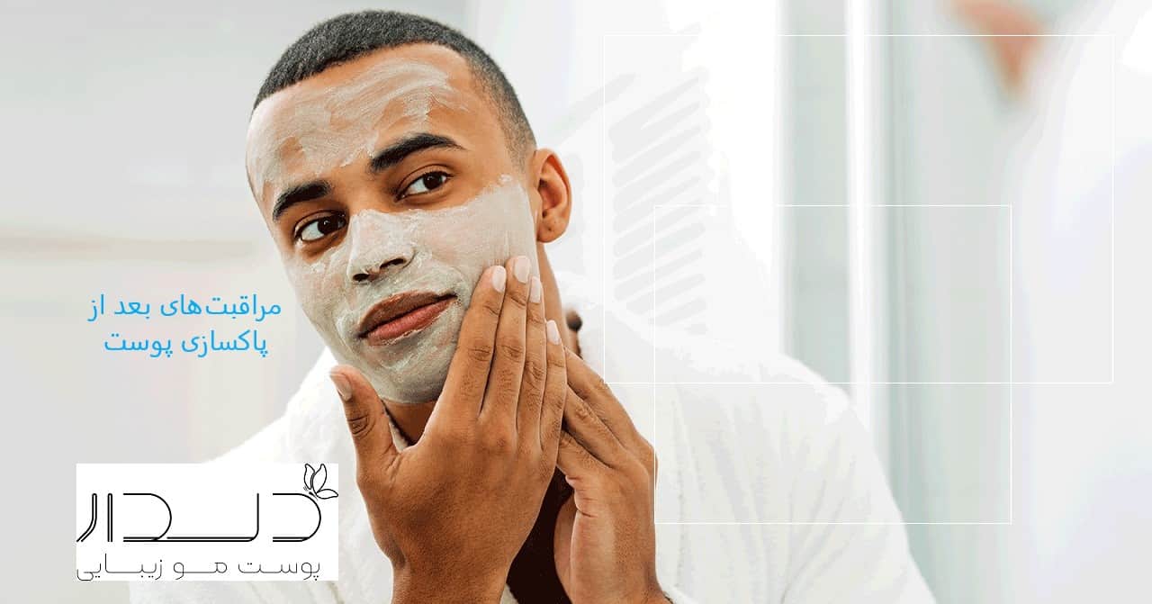 مراقبتهای پس از پاکسازی صورت