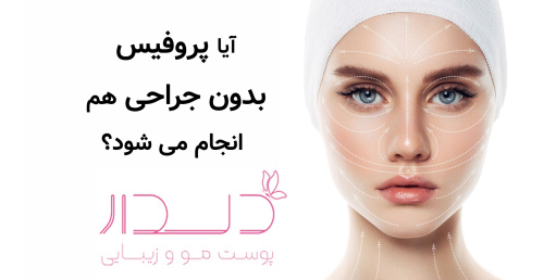 آیا پروفیس بدون جراحی هم انجام می‌شود؟
