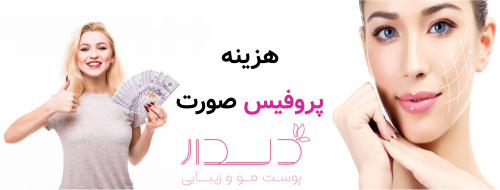 هزینه پروفیس صورت چقدر است؟
