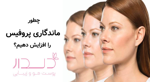 چطور ماندگاری پروفیس را افزایش دهیم؟