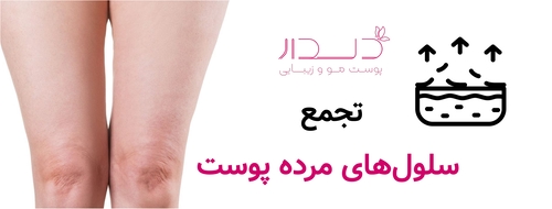 تجمع سلول های مرده پوست