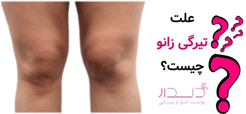 تیرگی زانو چیست؟