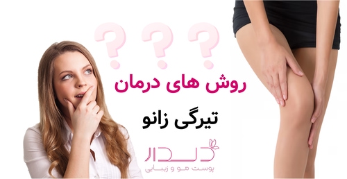 روش های درمان تیرگی زانو