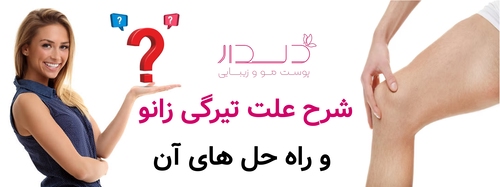 شرح علت تیرگی زانو و راه حل های آن