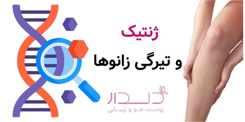 ژنتیک و تیرگی زانوها