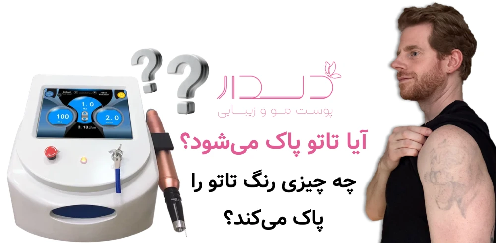 پاک کردن تاتوهای قدیمی راحت تر است یا جدید؟ آیا تاتو پاک میشود؟