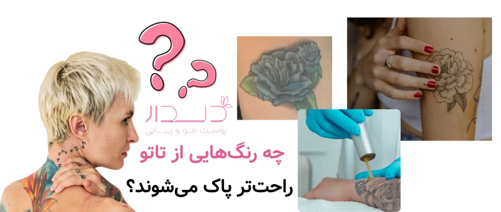 پاک کردن تاتوهای قدیمی راحت تر است یا جدید؟ چه رنگ‌هایی از تاتو راحت‌تر پاک می‌شوند؟