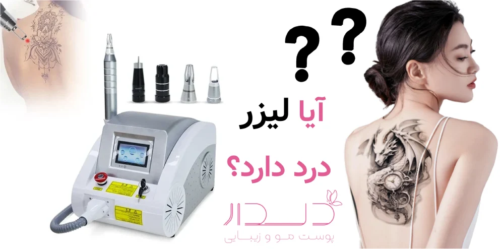 پاک کردن تاتوهای قدیمی راحت تر است یا جدید؟ آیا لیزر درد دارد؟
