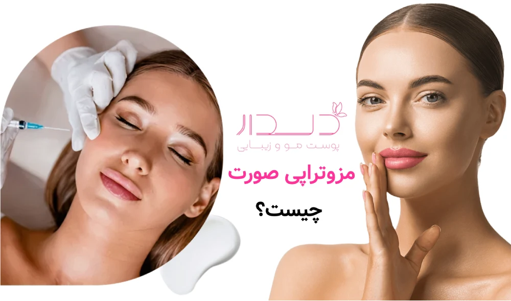 مزوتراپی صورت چیست و چگونه انجام میشود؟