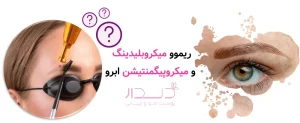 ریموو میکروبلیدینگ و میکروپیگمنتیشن ابرو | تفاوت پاک کردن با تاتو سنتی ابرو