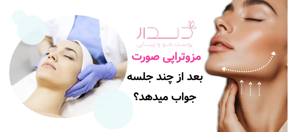 مزوتراپی صورت بعد از چند جلسه جواب میدهد؟