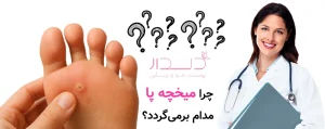 چرا میخچه پا مدام برمی‌گردد؟ | اشتباهات رایج در درمان میخچه